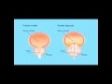 *Prostata ingrossata*  Dr Andrea Militello. *Urologo a Roma/ Viterbo/ Rieti *.